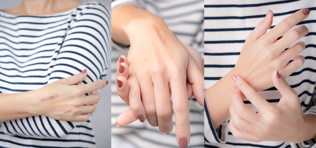 Szkolenie terapii blizn Szczecin jako ważny element współczesnej działalności z pacjentem